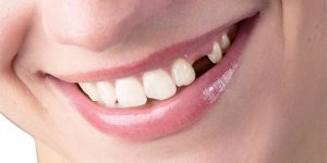 Nằm Mơ Thấy Rụng Răng Điềm Báo Lành Hay Dữ Và Con Số Phát Tài