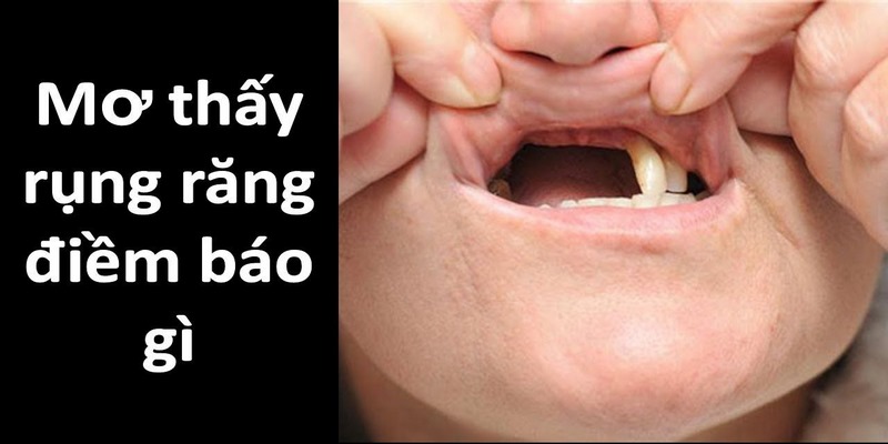 Ý nghĩa nằm mơ thấy rụng răng chi tiết nhất